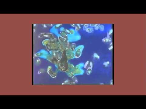 Melodium - Kissing Disease (K-Conjog Remix)