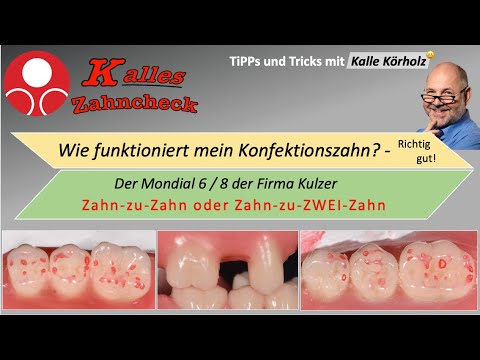 Kalles Zahncheck: Die Zahn-zu-ZweiZahn und die Zahn-zu-Zahn-Beziehung des Mondial 8