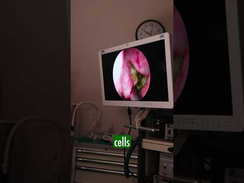 ALLERGY MYTHS! #allergies #nasal #sinus #allergy #sinusitis #mucus #entsurgeon #breathe