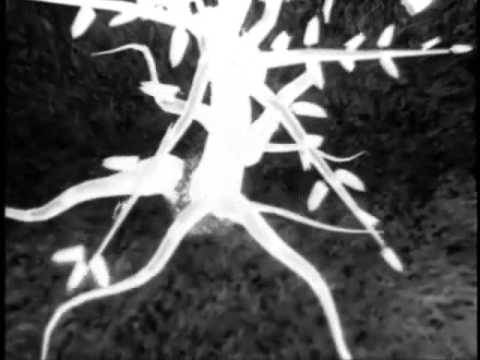 Keane - Walnut Tree