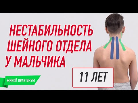 Кинезио тейп BBTape™ 5 см × 17 м бежевый (серия SMILE) Фото 10