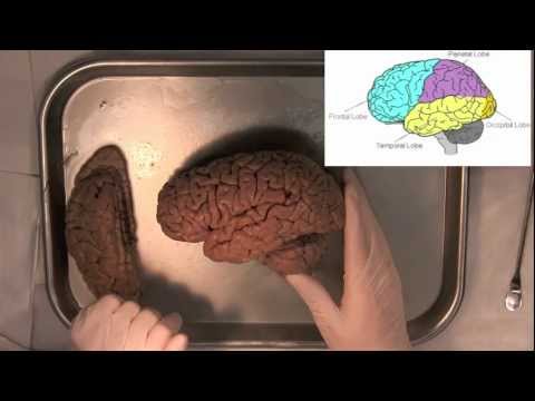 MIT Introduction to Neuroanatomy Series: Part 1