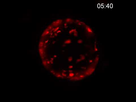 Scientists unravel the key to colon cancer relapse after chemotherapy