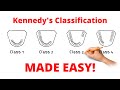 Kennedy's Classification and Applegate's rules