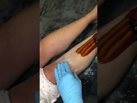 Leg Sugaring