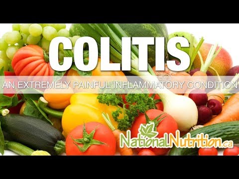 Colitis