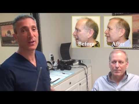 Pat's Undetectable Scar: 4mo