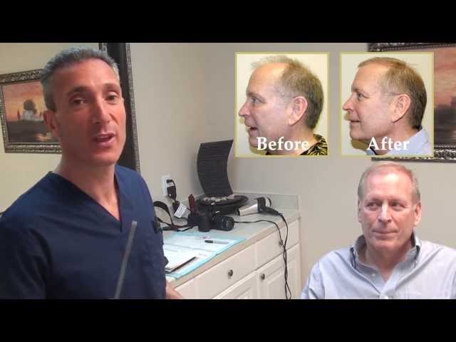 Pat's Undetectable Scar: 4mo