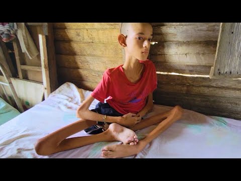 🥺Ayúdame ayudar a este niño del municipio Velasco provincia de Holguin 