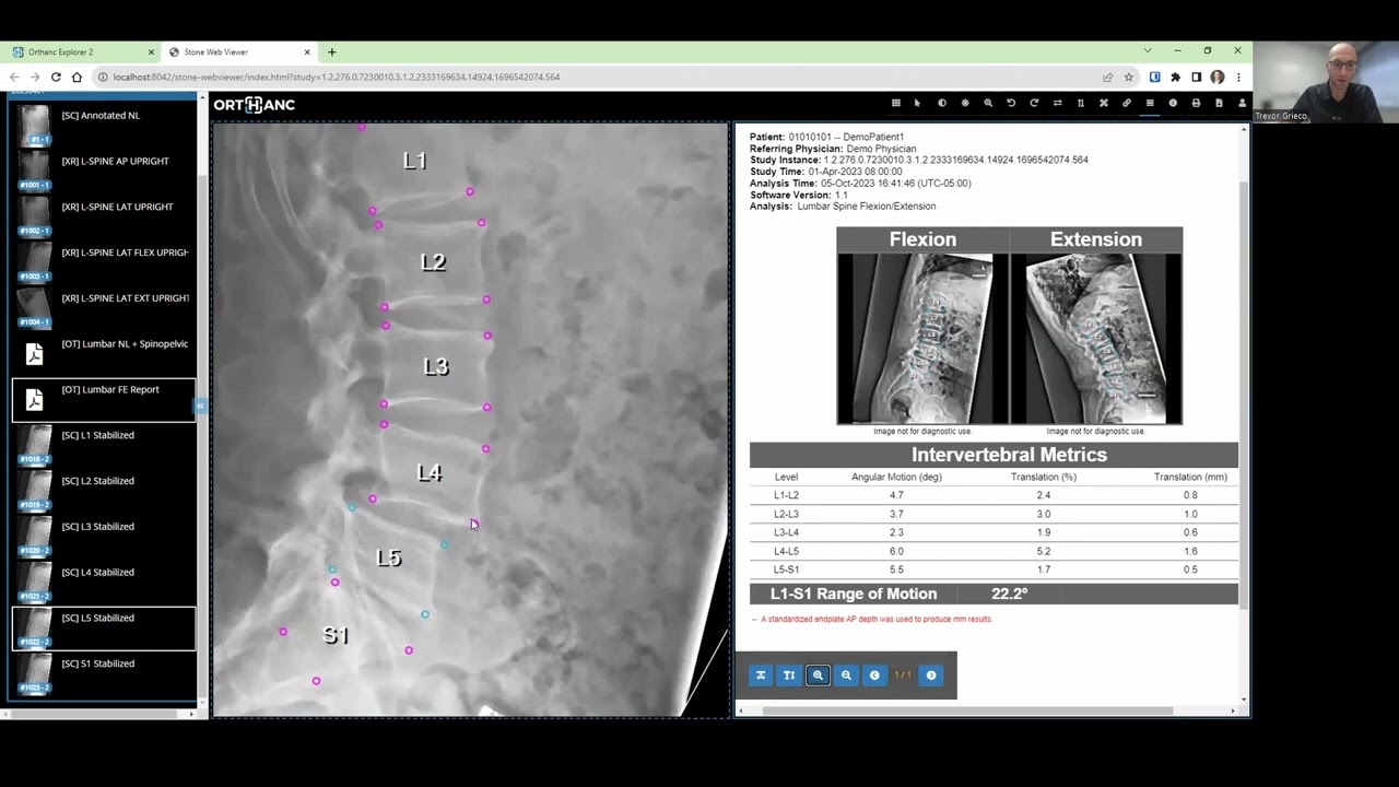 SpineCAMP Demonstration