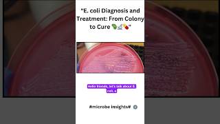 Download lagu 'E. coli Diagnosis and Treatment: From Colony to Cure 🦠🔬'#EColiIdentification#EColiFacts#EColicolony mp3