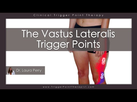 The Vastus Lateralis Trigger Points