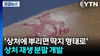 '상처에 뿌리면 딱지 형태로 변한다'...상처 재생 분말 개발 / YTN
