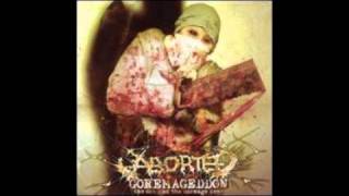 Aborted-Parasitic Flesh Resection