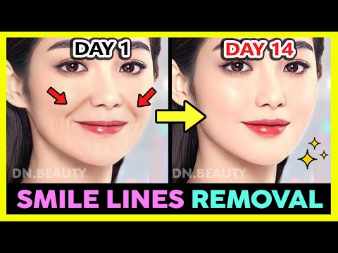✨ SMILE LINES (LAUGH LINES) REMOVAL AND FILL WITH KOREAN FACE EXERCISE & MASSAGE IN 2 WEEKS