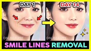 ✨ SMILE LINES (LAUGH LINES) REMOVAL AND FILL WITH KOREAN FACE EXERCISE & MASSAGE IN 2 WEEKS