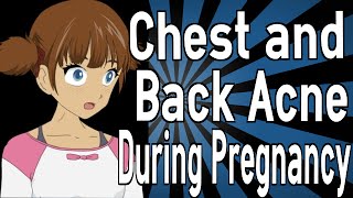Chest and Back Acne During Pregnancy