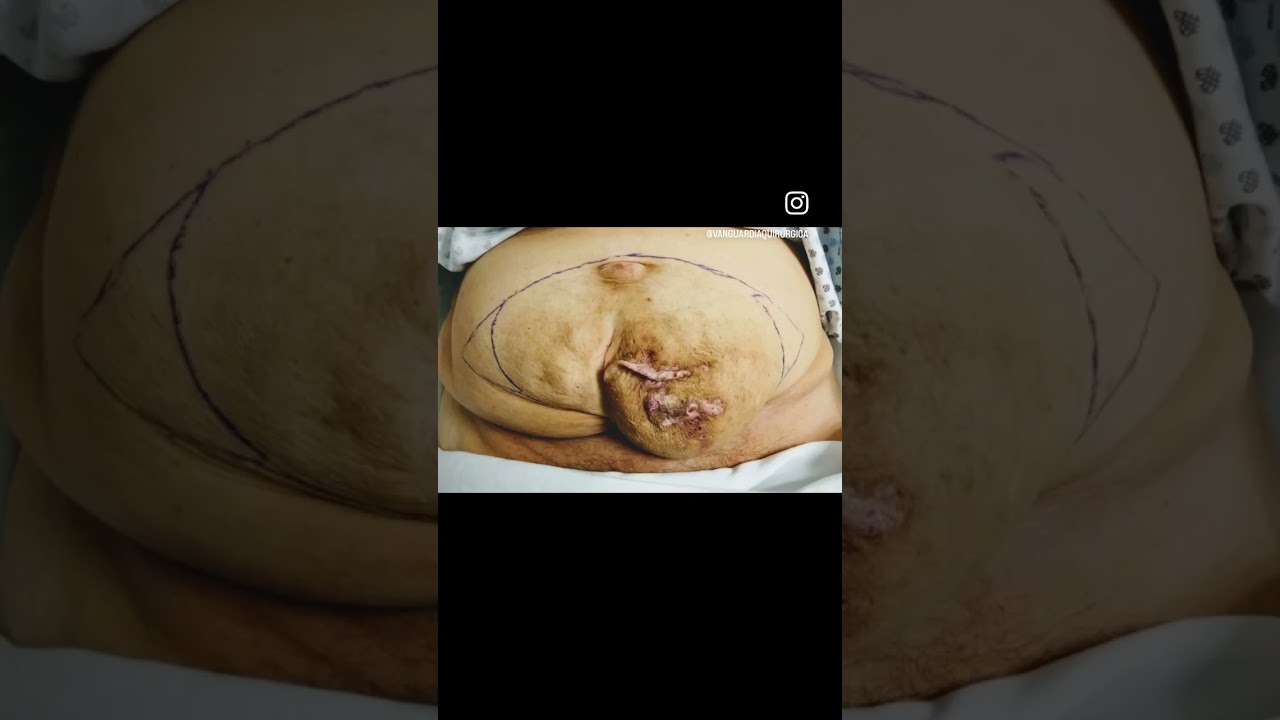 Luis Angel Medina Andrade-39