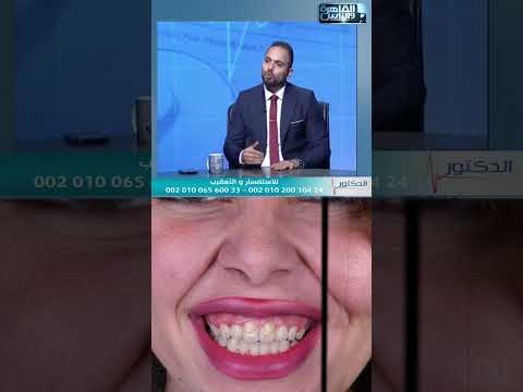 مقابلة — إعادة تأهيل الفكين