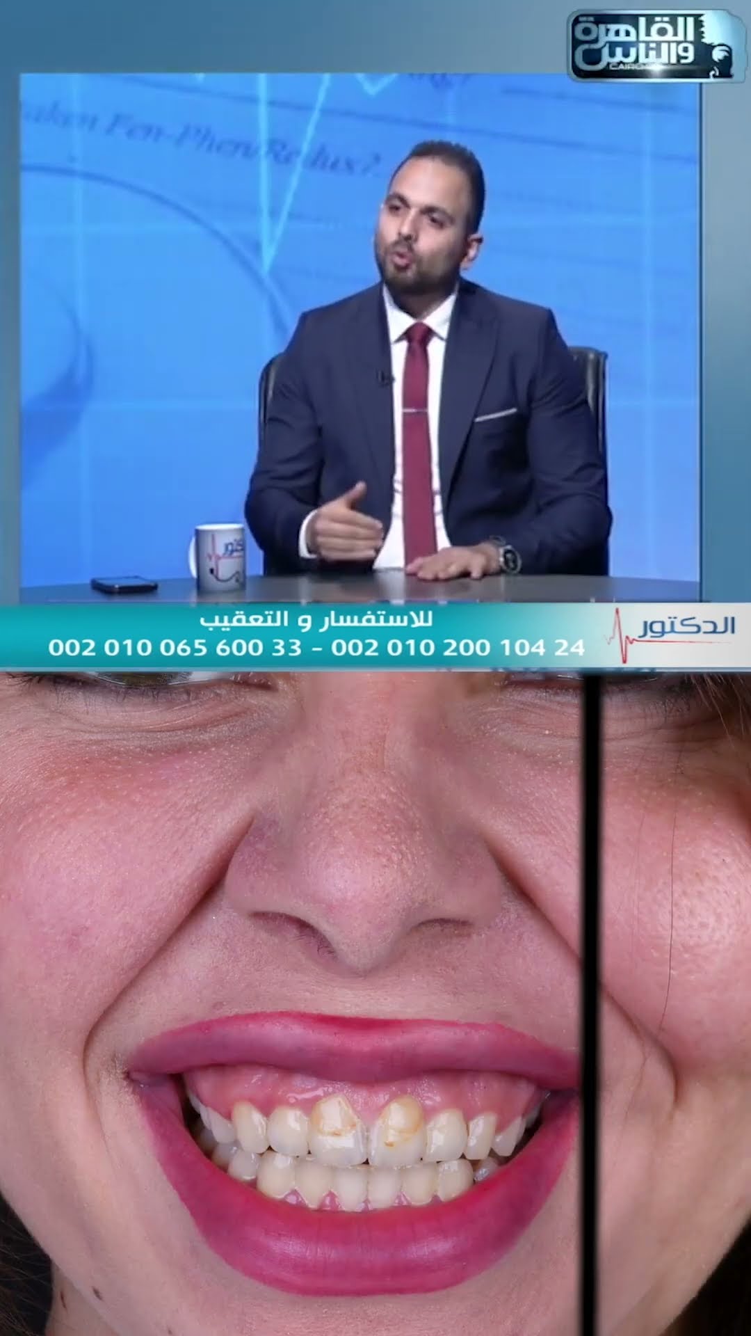 مقابلة — إعادة تأهيل الفكين