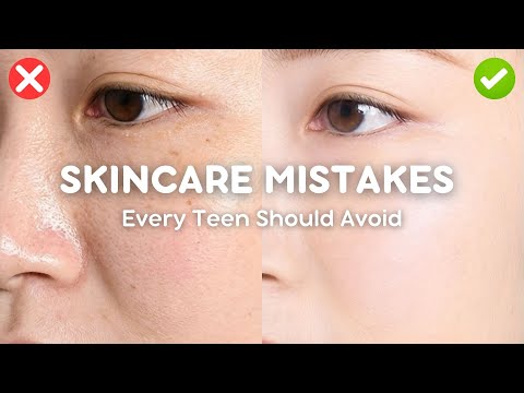 skincare mistakes every teen should avoid 🚫💧 (say goodbye to breakouts!)