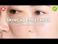 Skincare Mistakes Every Teen Should Avoid Say Goodbye To Breakouts