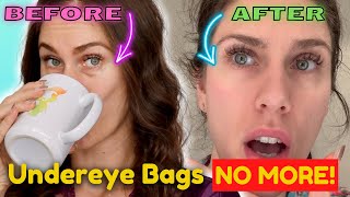 Did I Find A $4 Dupe For The $14 Microneedling Eye Patches!!