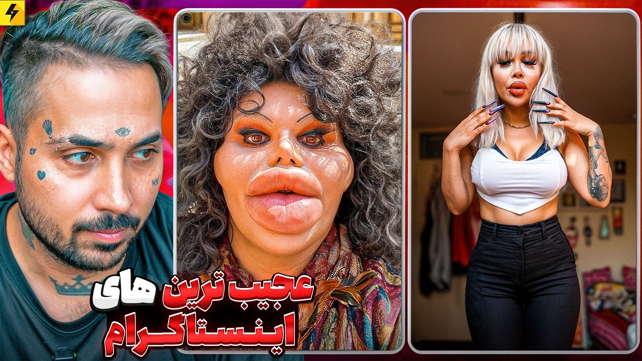 هفتصد میلیون پول لیپوساکشن | دیوانه خانه ای به نام اینستاگرام