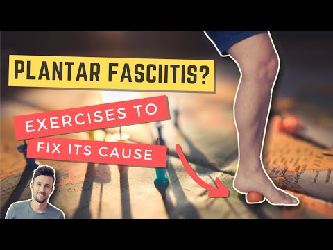 Top 3 Exercises to Treat Plantar Fasciitis and Fix its Cause