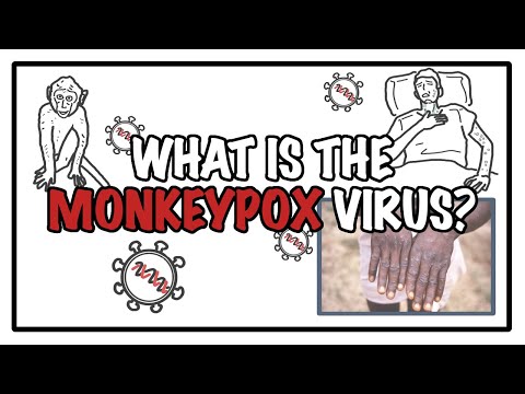 ¿Qué es el virus de la viruela del mono?