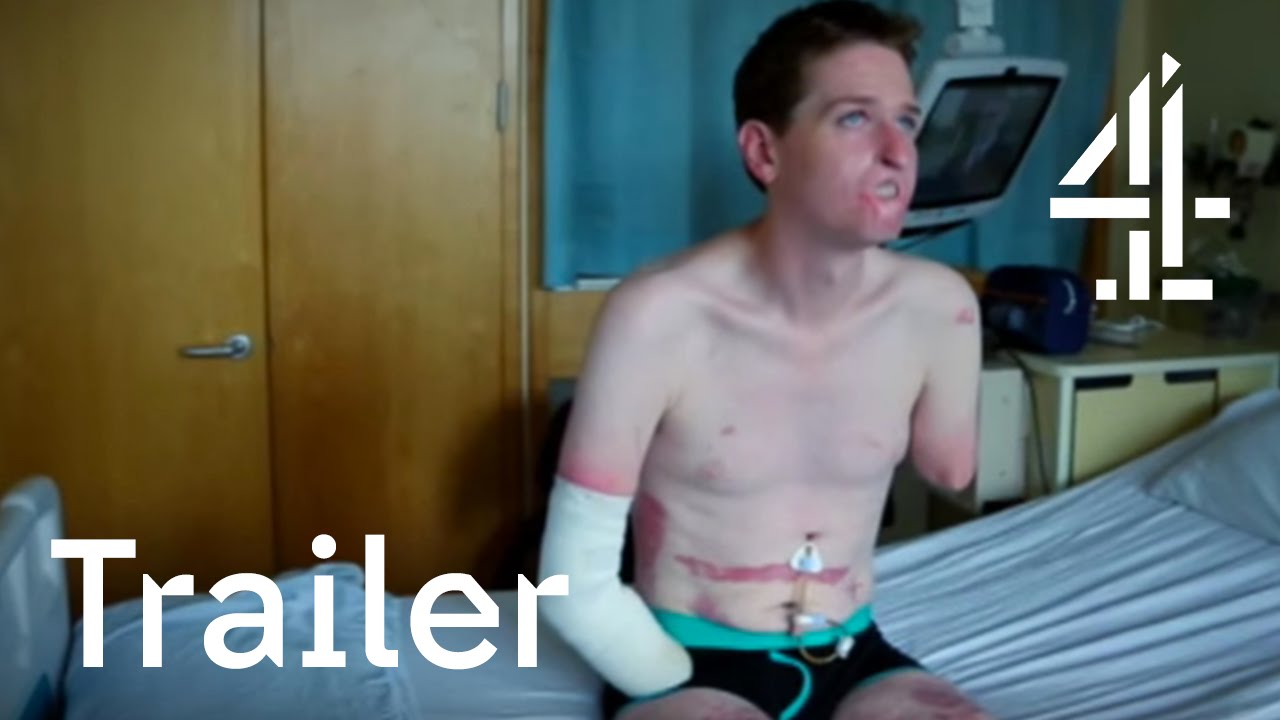 TRAILER: The Extraordinary Case of Alex Lewis