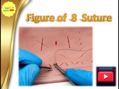Figure of eight suture