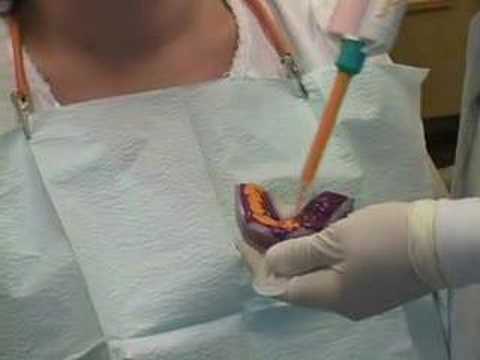 Prelimiary impression technique for a diagnostic wax-up