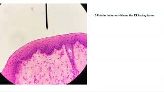 Epithelial Tissue Practice quiz