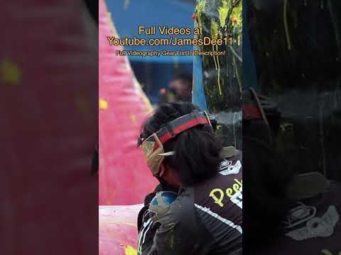 He almost lost his eye!