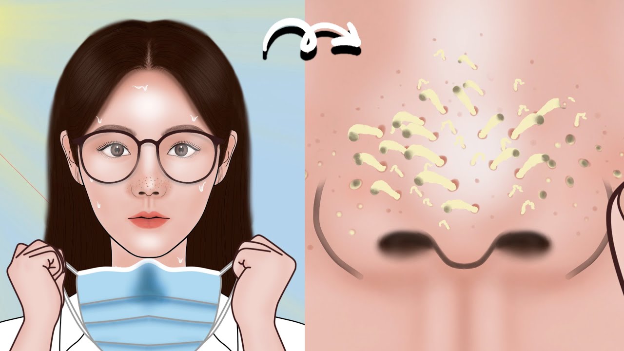 Satisfying Full Blackhead Treatment At Home! ASMR skincare animation丨Meng's Stop Motion