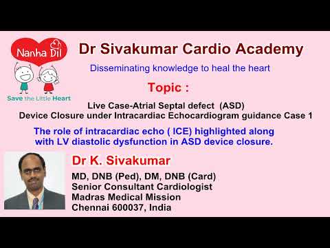 4/12 Live Case - Atrial Septal defect ASD Device Closure under Intracardiac Echocardiogram -Case 1