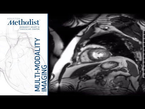 Cardiovascular MR: Basic Principles and Overview of Technique (Dipan J. Shah, MD) October 6, 2020