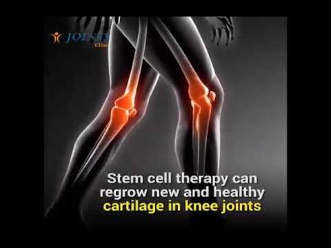 Stem cell therapy to regrow new and healthy cartilage for knee joints