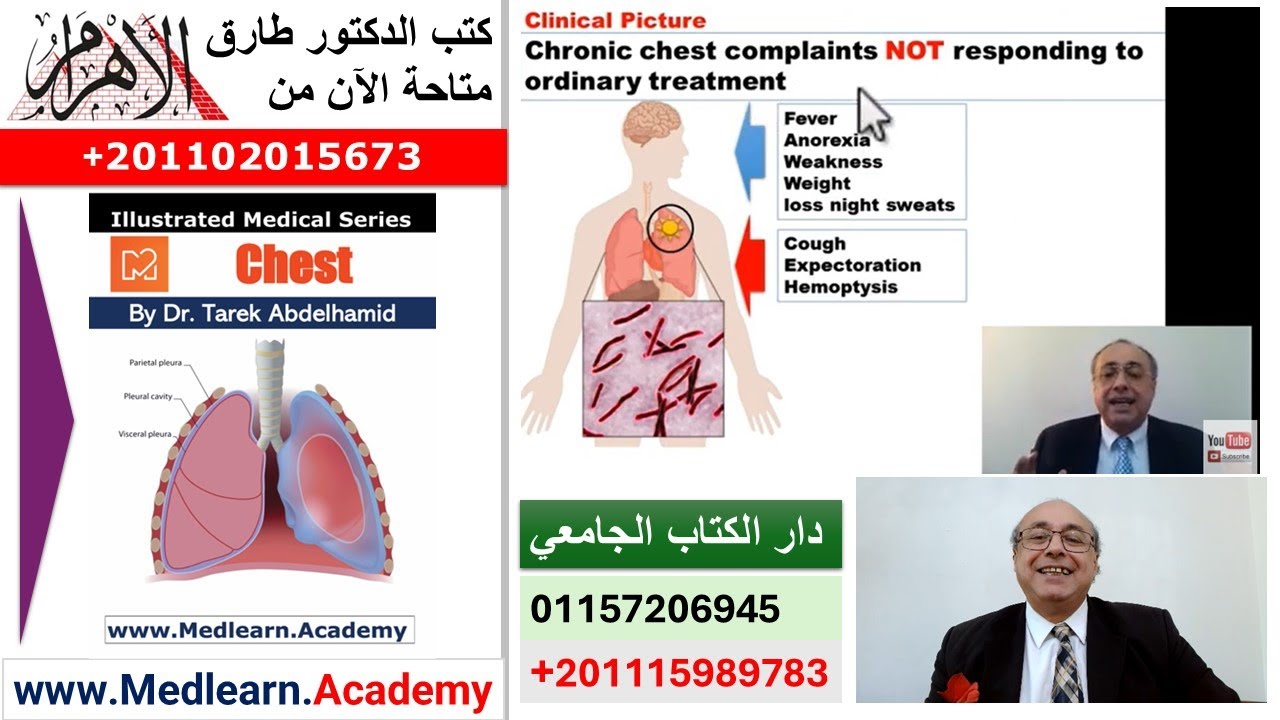 Tuberculosis (I)   #cme #internal_medicine #medical #usmle #محاضرات_باطنة #medicalstudent