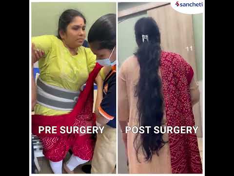 High-Grade Spondylolisthesis: How We Helped Her Walk Again