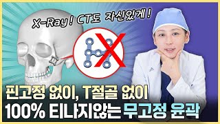 핀이 없으니 수술한 티도 안 나지!, 무고정 윤곽 #안면윤곽 #윤곽수술 #사각턱 #광대