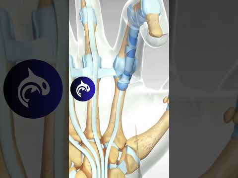 See how a Trigger Finger is released - 3D Animation #hand #orthopedics