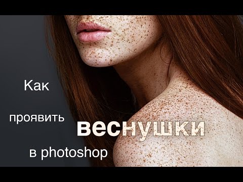 От чего на висках пигментные пятна Удаления пигментных пятен лазером