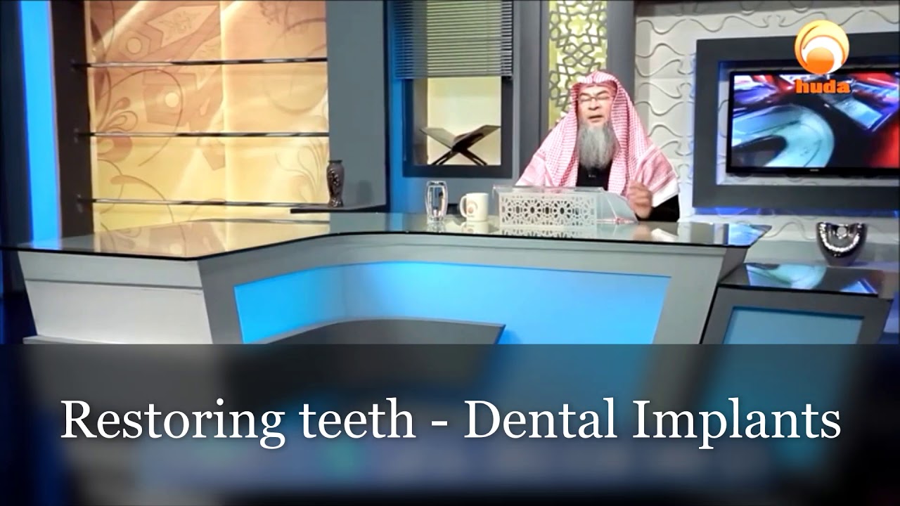 Dental implants - Assim al hakeem