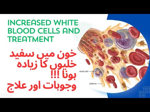 white blood cells Kam ya zayada hona ki waja -normal kesa krn -treatment options-WBC ka asan ilaj