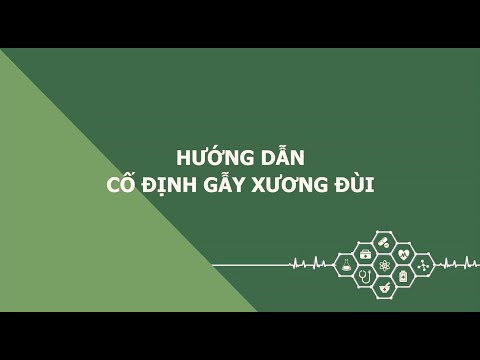 Hướng dẫn cố định gẫy xương đùi