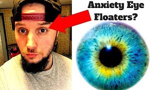 Anxiety Eye Floaters (ANNOYING)