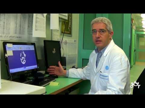 Articolazioni intervertebrali del rachide cervicale Quali esercizi per larticolazione dellanca