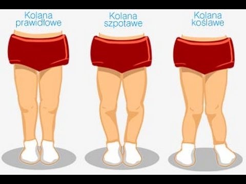 Kości na palcu stopy Gimnastyka dla dzieci z koślawości stóp na zdjęciach